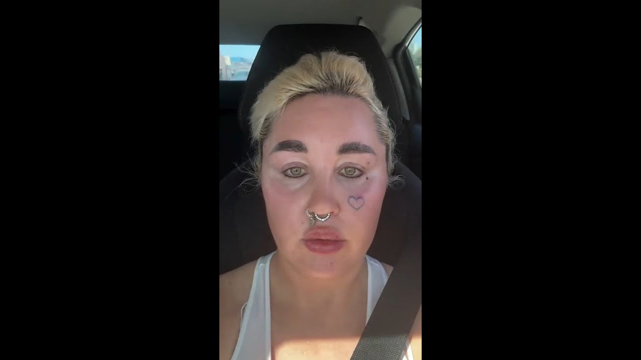 Amanda Bynes reveals new cosmetic procedure