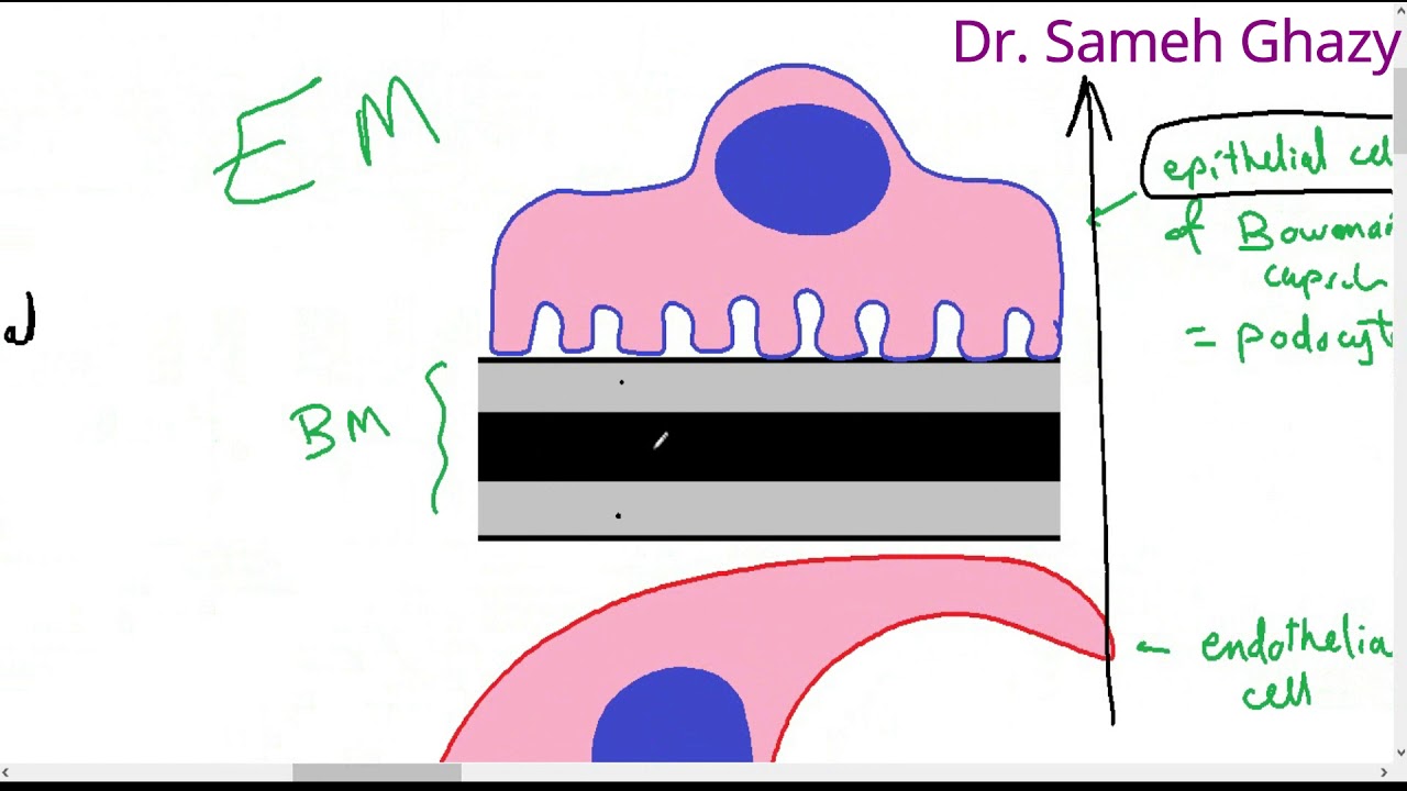 systemic pathology 47 : Urinary system 1  (pathology of glomerular diseases ) DR. SAMEH GHAZY
