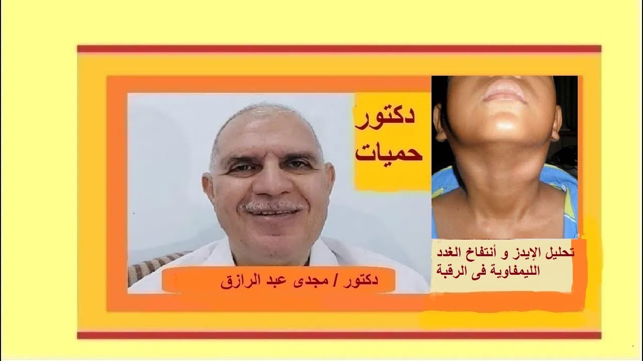 تحليل الإيدز و أنتفاخ الغدد الليمفاوية فى الرقبة |  HIV test