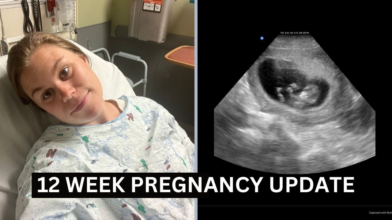 12 WEEK PREGNANCY UPDATE - IN THE ER - BLEEDING AT 12 WEEKS PREGNANT