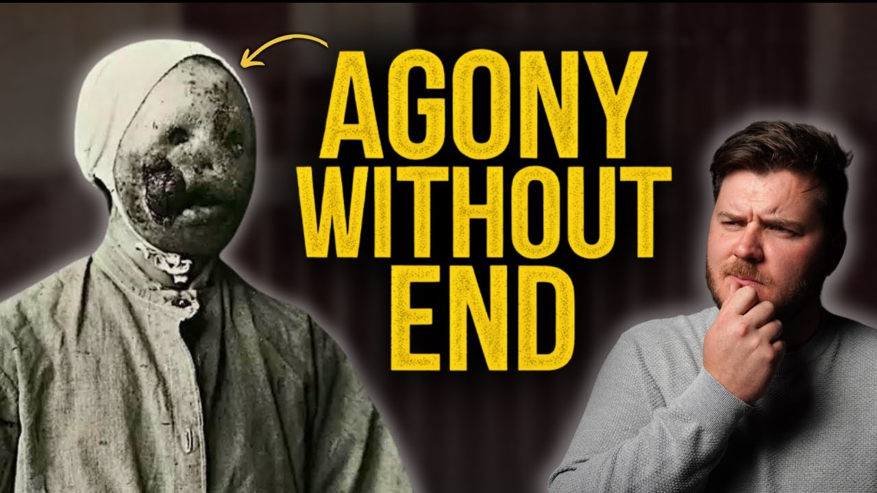 The Disturbing History of Leprosy