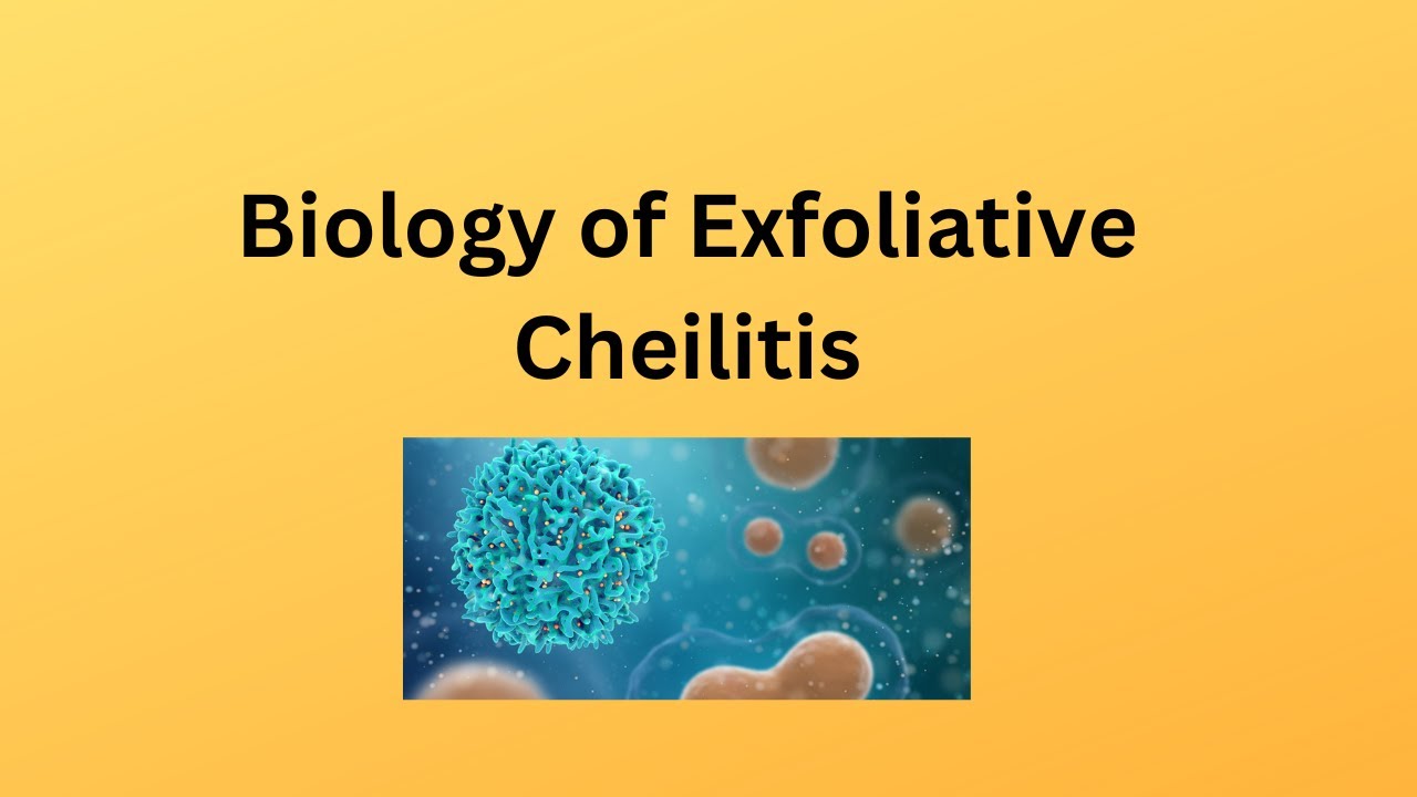 Understanding Exfoliative Cheilitis  Biological Insights for Healthcare Professionals and Patients