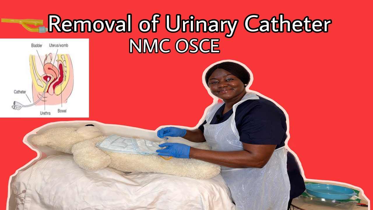 Removal of Urinary Catheter
