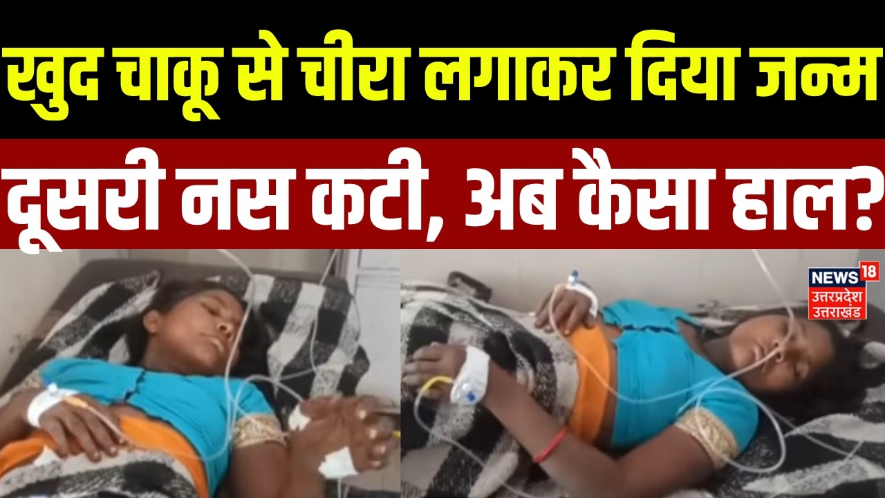 Bahraich News: खुद चाकू से चीरा लगाकर दिया जन्म...दूसरी नस कटी, अब कैसा हाल? | UP | Condition