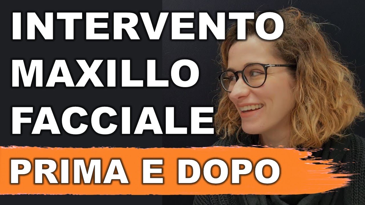 Intervento maxillo facciale prima e dopo: ripercorriamolo con Marta