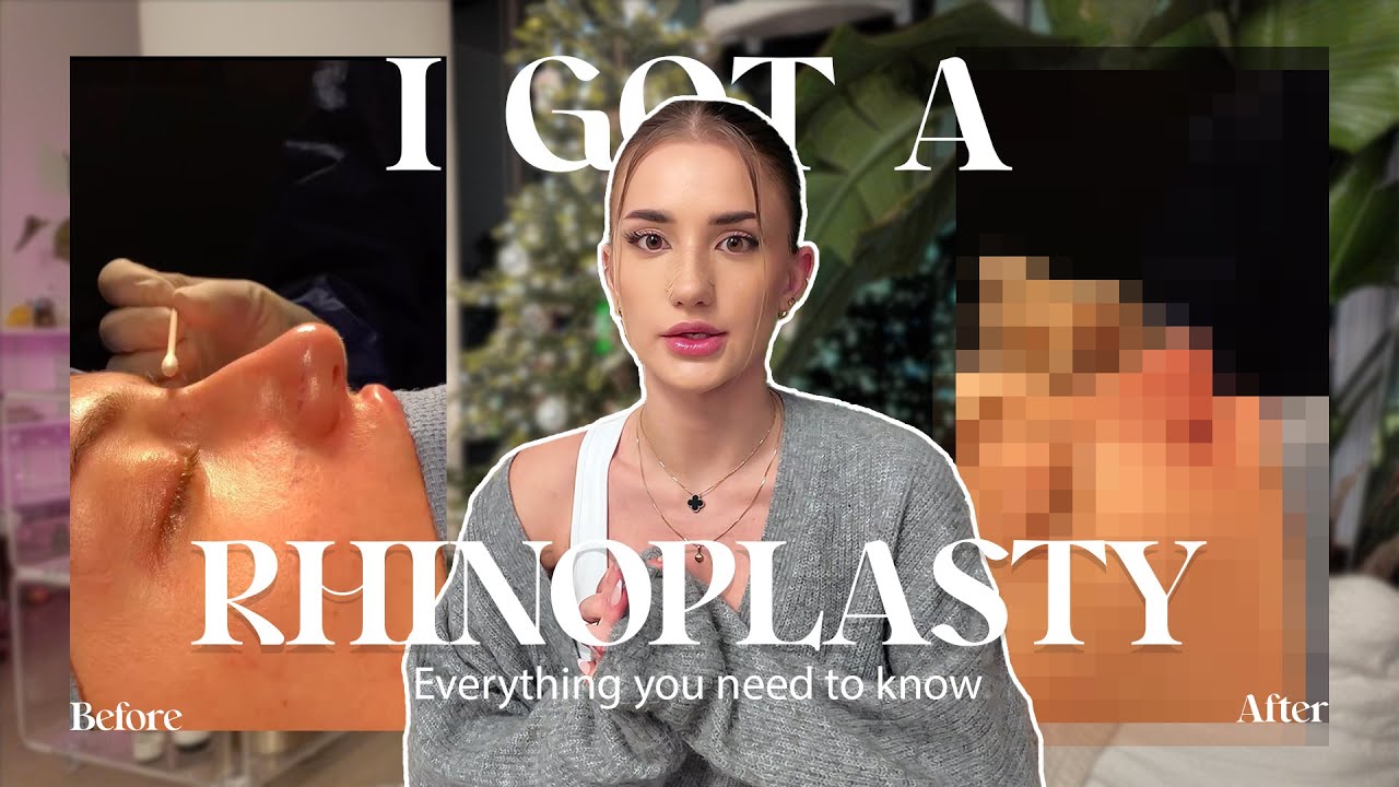 I got a nosejob in a week | What you need to know ♡