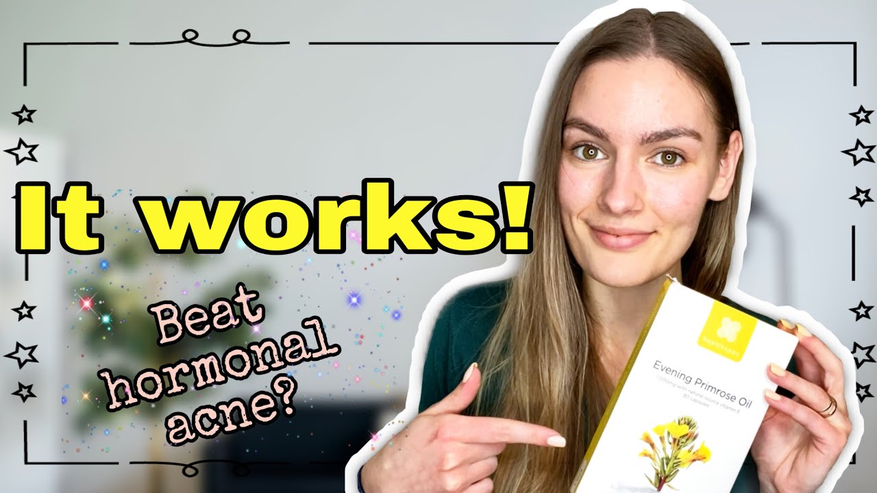 I Used Evening Primrose Oil For Hormonal Acne| Results After 4 Months!