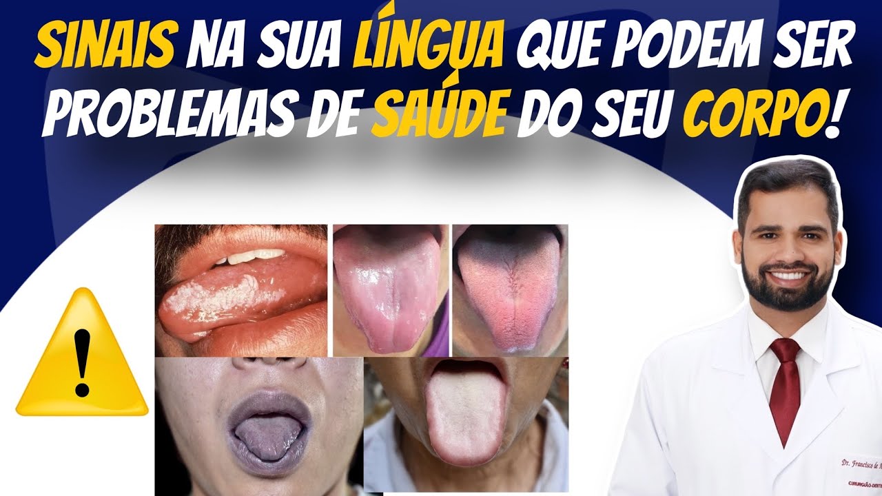 Sinais na sua LÍNGUA que podem ser problemas de saúde do seu corpo! #saúde #boca #estomatologia