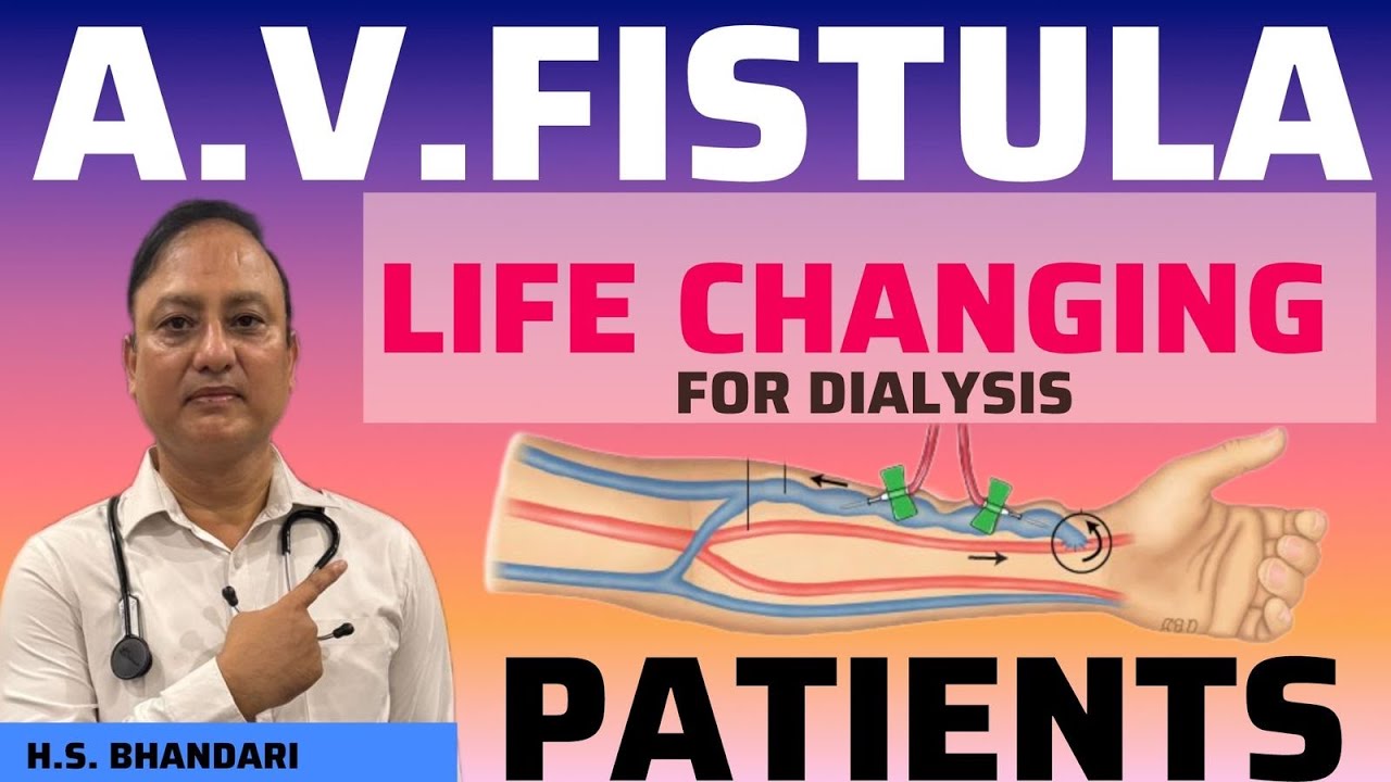 Why do dialysis patients must have AV fistula # sites#complication#care# needling