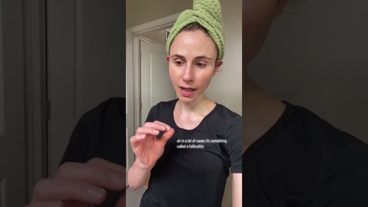 Bolesne pryszcze na pośladkach #dermatolog @DrDrayzday