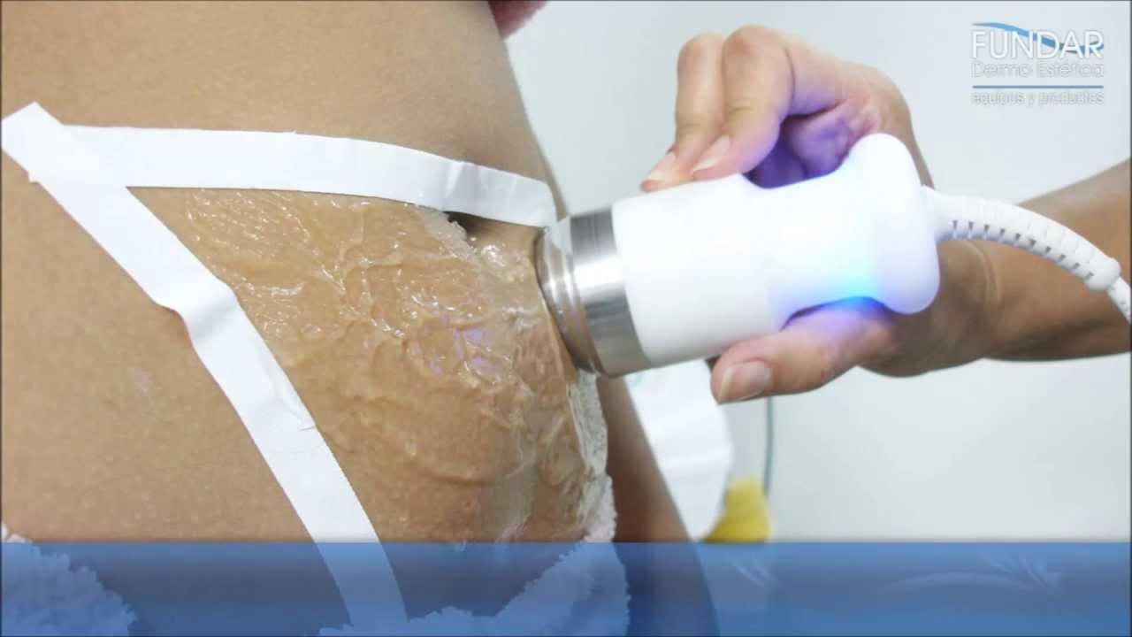 Lipoline - Lipo sem corte - Lipoescultura N&atilde;o Invasiva