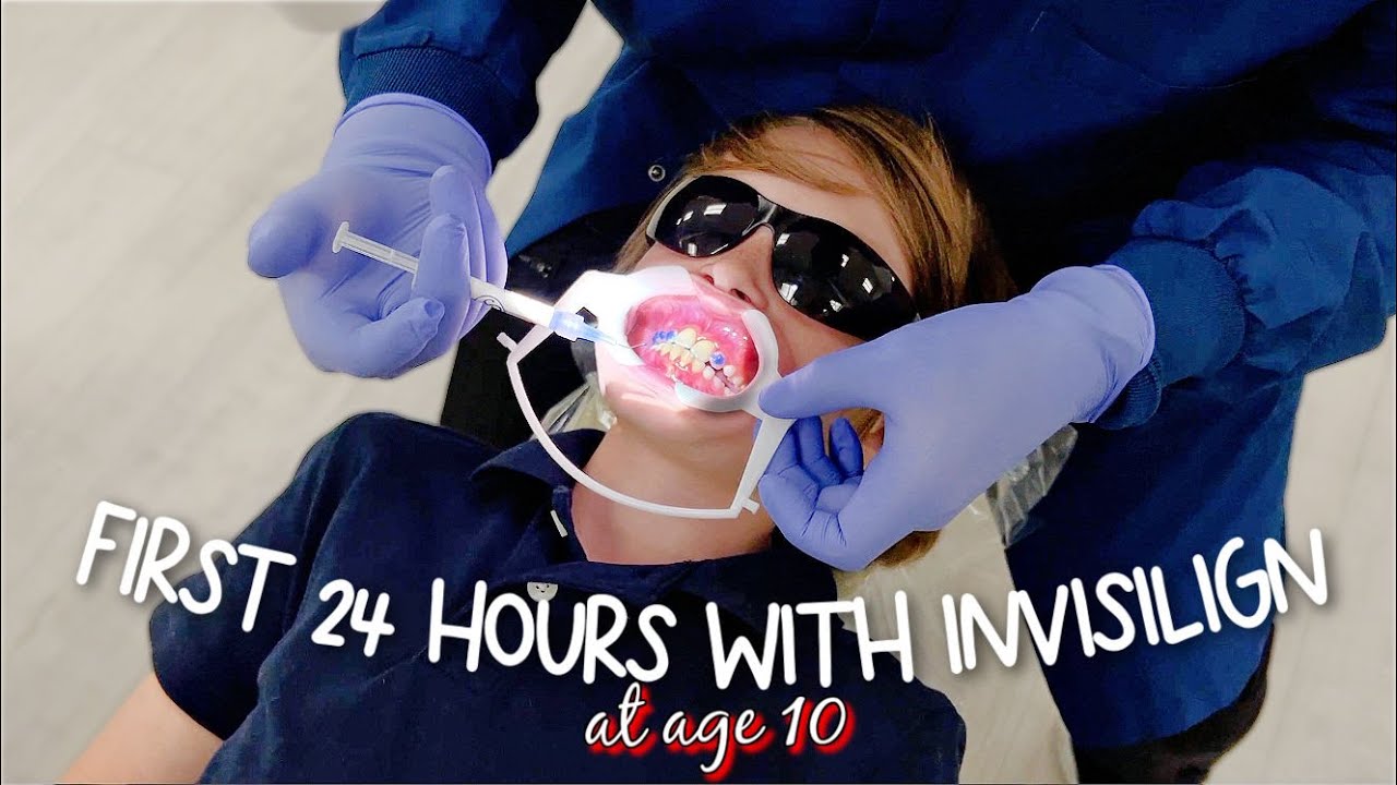 First 24 HOURS of Invisalign (braces at 10 years old)