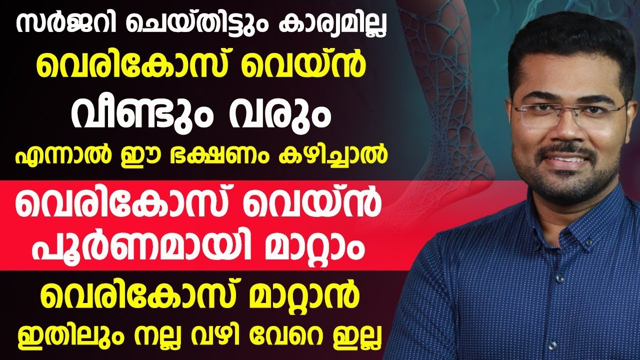 ഈ ഭക്ഷണം കഴിച്ചാൽ വെരികോസ് വെയ്ൻ പൂർണമായി മാറ്റം | dr manoj johnson varicose veins treatment