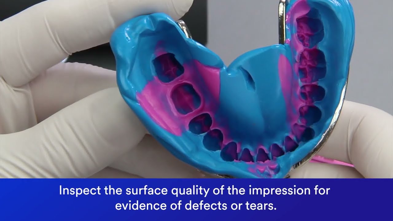 Imprint 4 Impression Technique with 3M