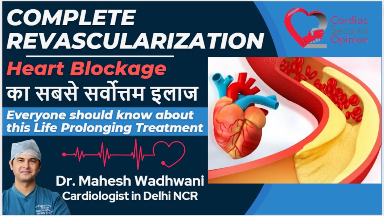 Heart Blockage का सबसे सर्वोत्तम इलाज l Complete Revascularization l Revascularization Techniques