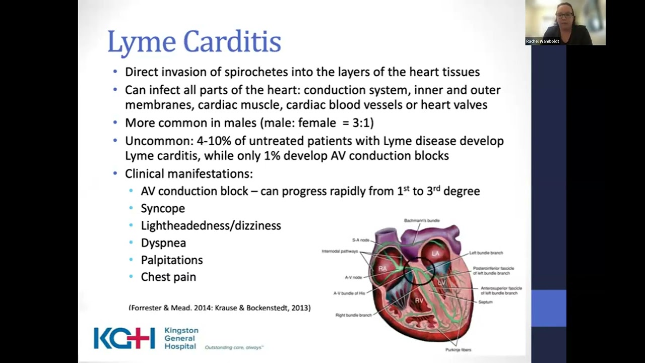 Lyme Carditis 2023 Update on Clinical Management (Dr. Rachel Wambolt)