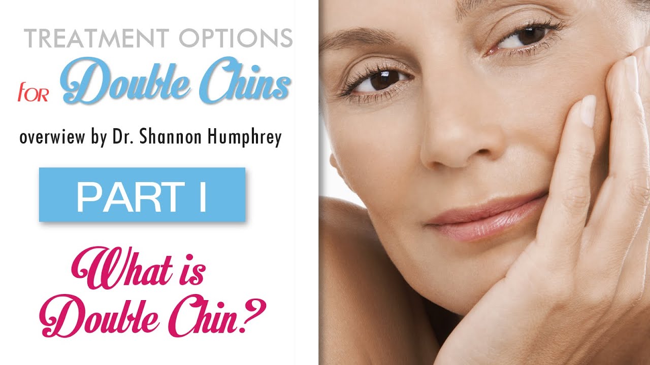 What is double chin? Part 1 of Kybella/Belkyra series