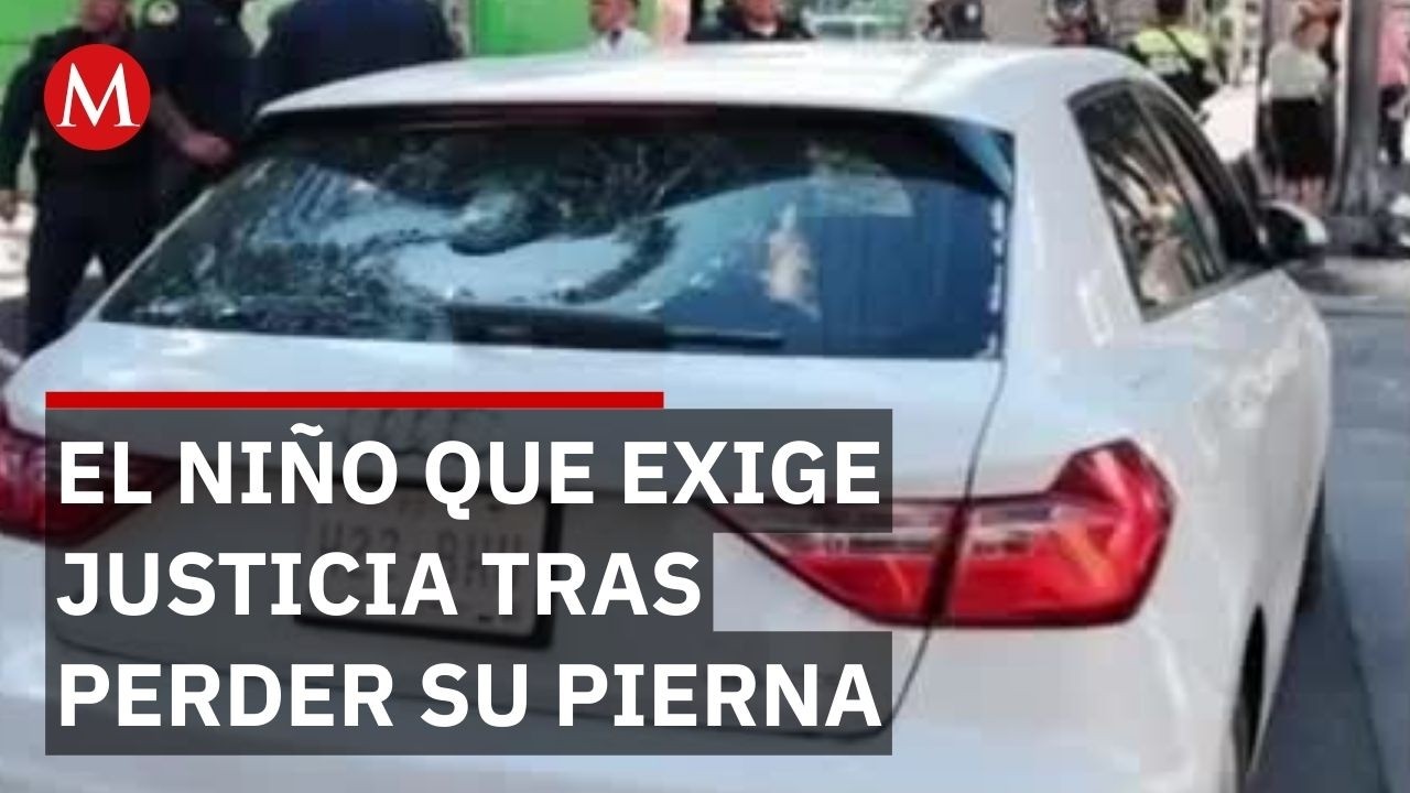 Un niño de 8 años pierde su pierna por conductora ebria en la CdMx