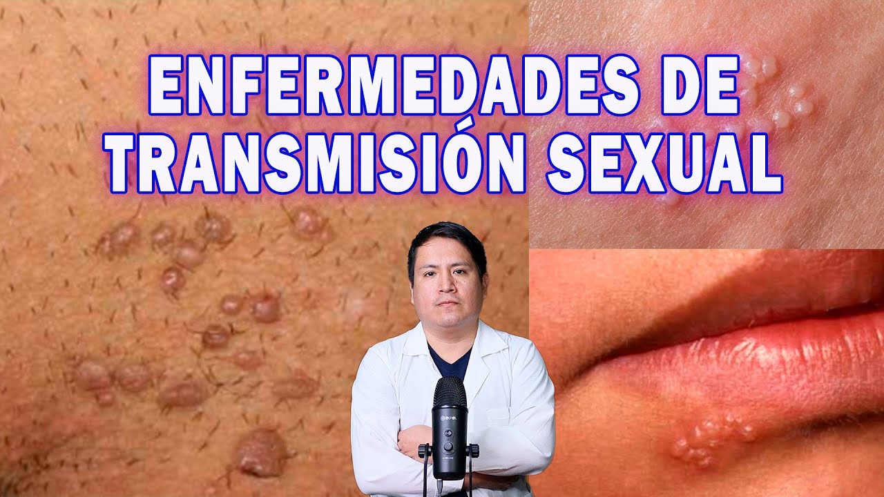 CÓMO SABER SI TIENES UNA ENFERMEDAD DE TRANSMISIÓN SEXUAL