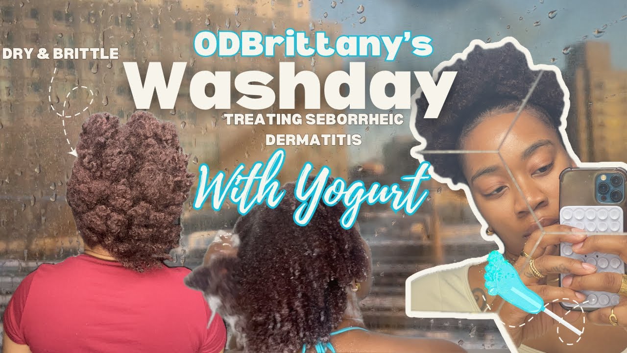 Treating Seborrheic Dermatitis with Yogurt| ODBrittany