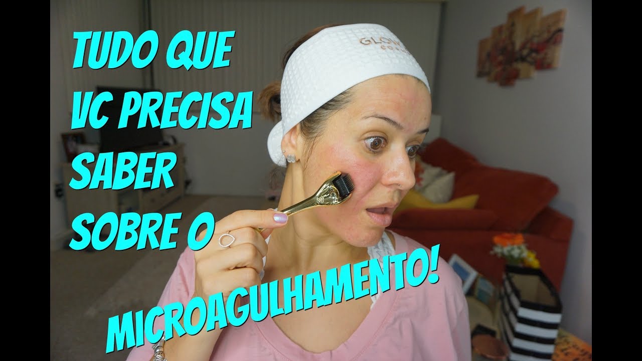 TUDO que vc precisa saber sobre o MICROAGULHAMENTO!