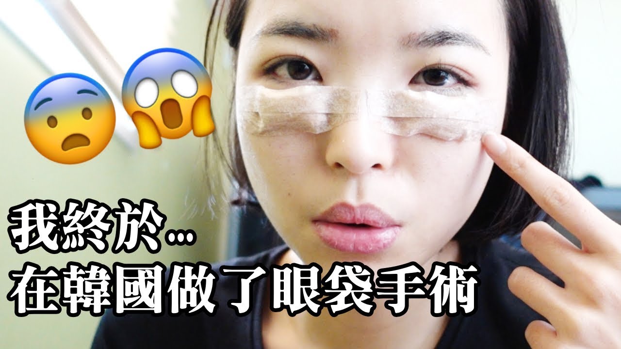 終於...在韓國動刀整形❓在韓國做眼袋手術+術後7天完整紀錄Eye bags Surgery｜一隻阿圓