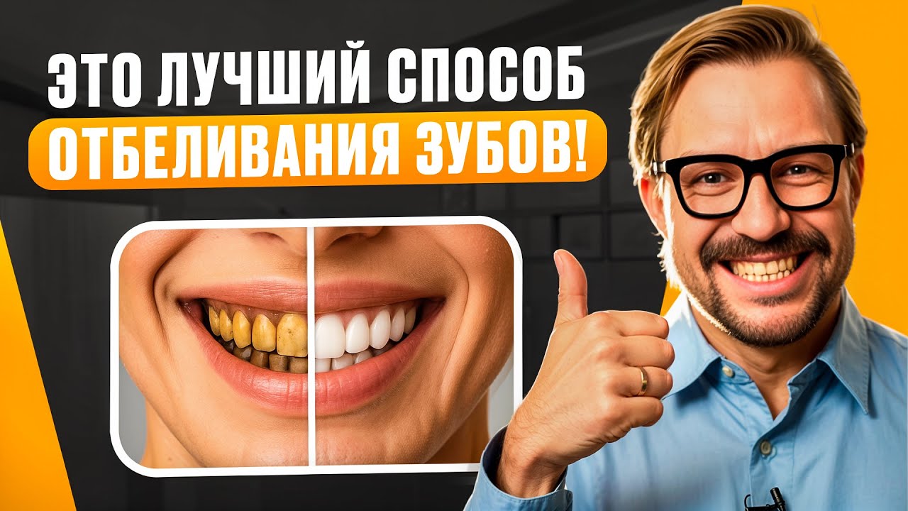 Какой способ отбеливания САМЫЙ БЕЗОПАСНЫЙ для эмали в 2026?