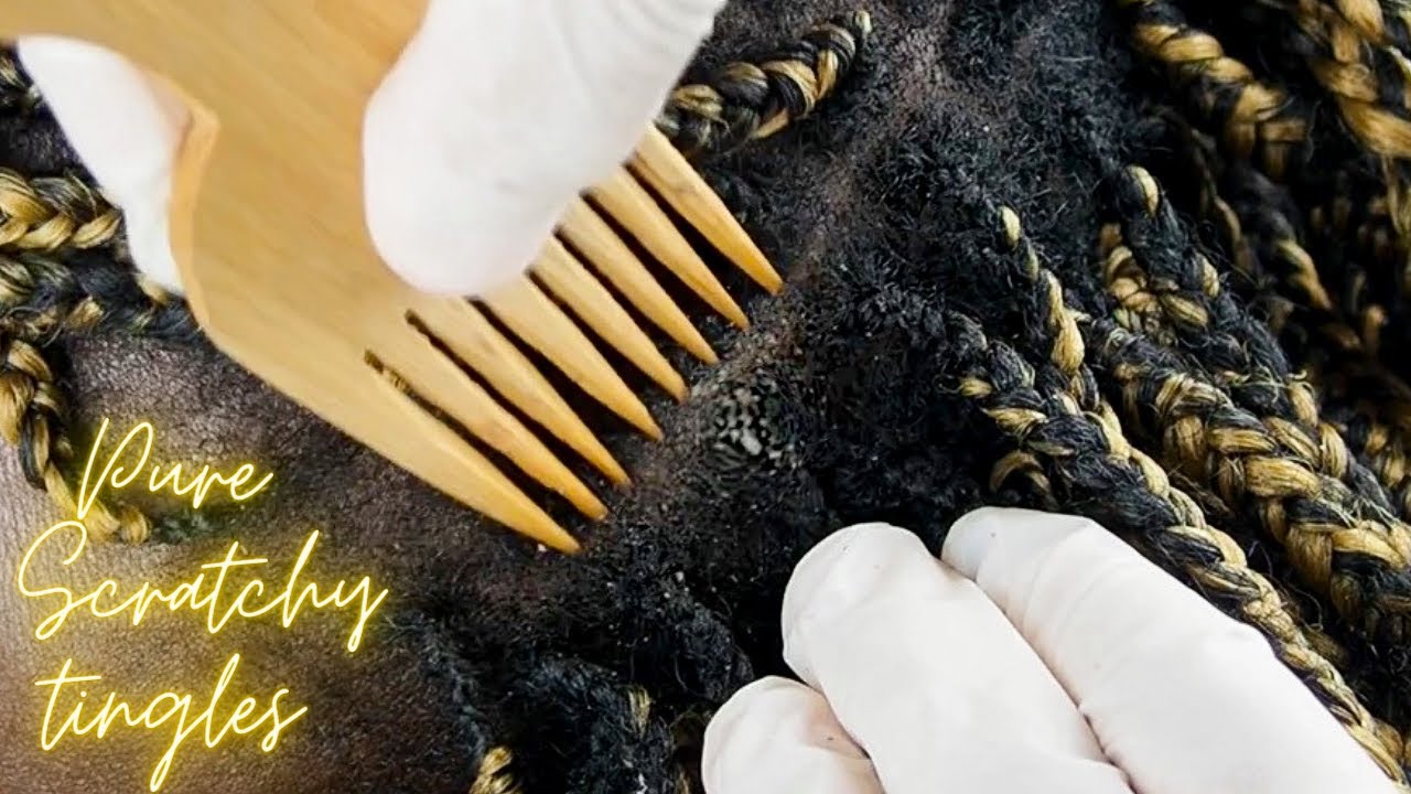 {ASMR} Fast and Aggressive Scratching dry flakes BETWEEN BRAIDS