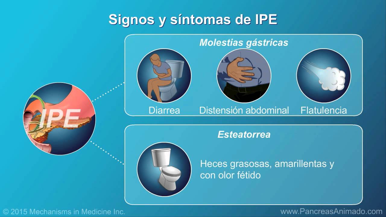 Insuficiencia pancreática exocrina (IPE)