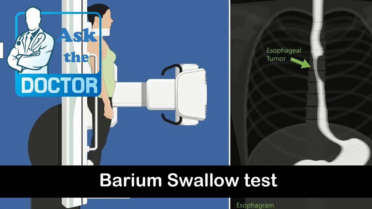 Barium Swallow test