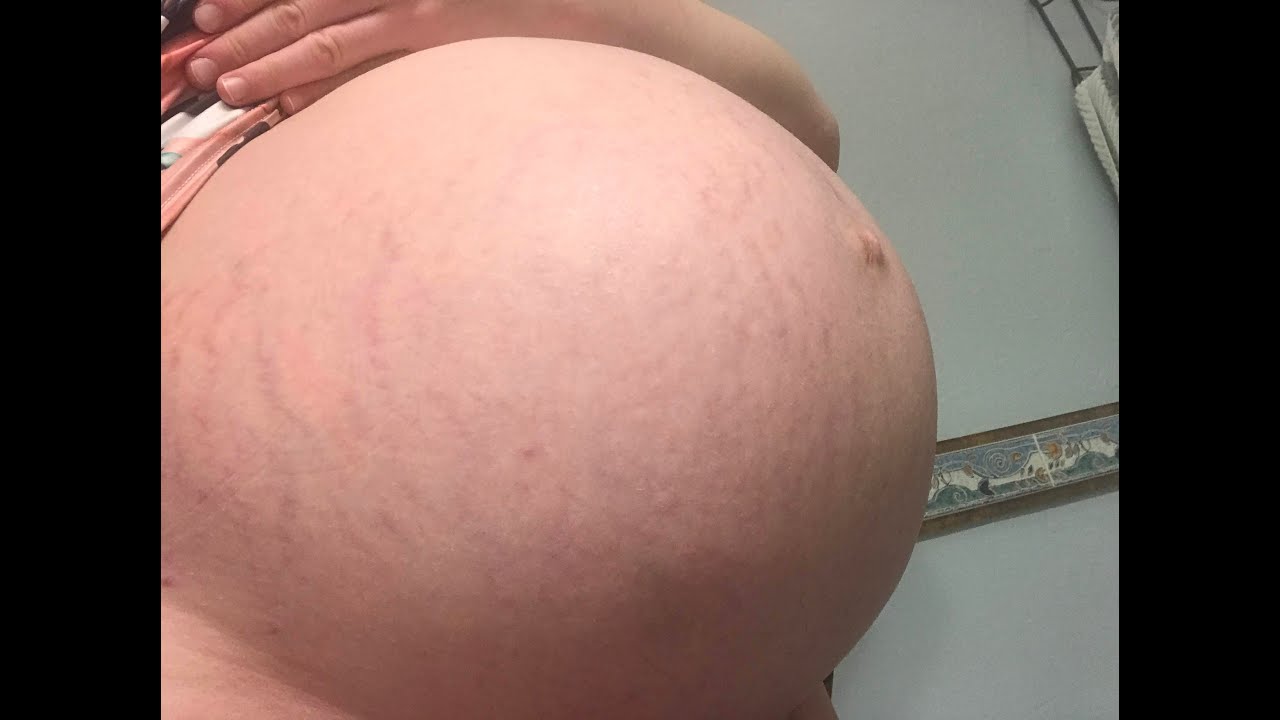 Twin Pregnancy Bump Progression