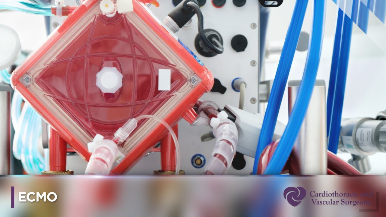 ECMO | Cardiothoracic and Vascular Surgeons | CTVS Texas