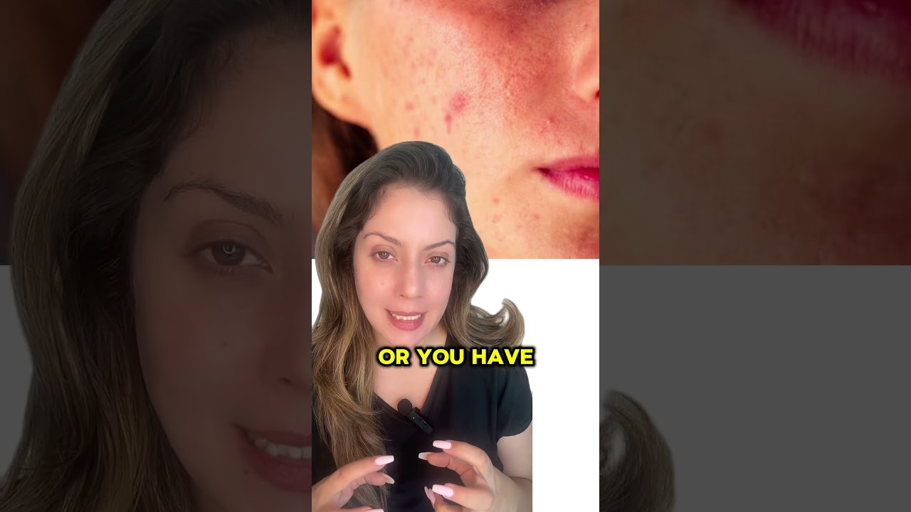 How to Choose the Best Vitamin C Serum for Your Skin | Nipun Kapur