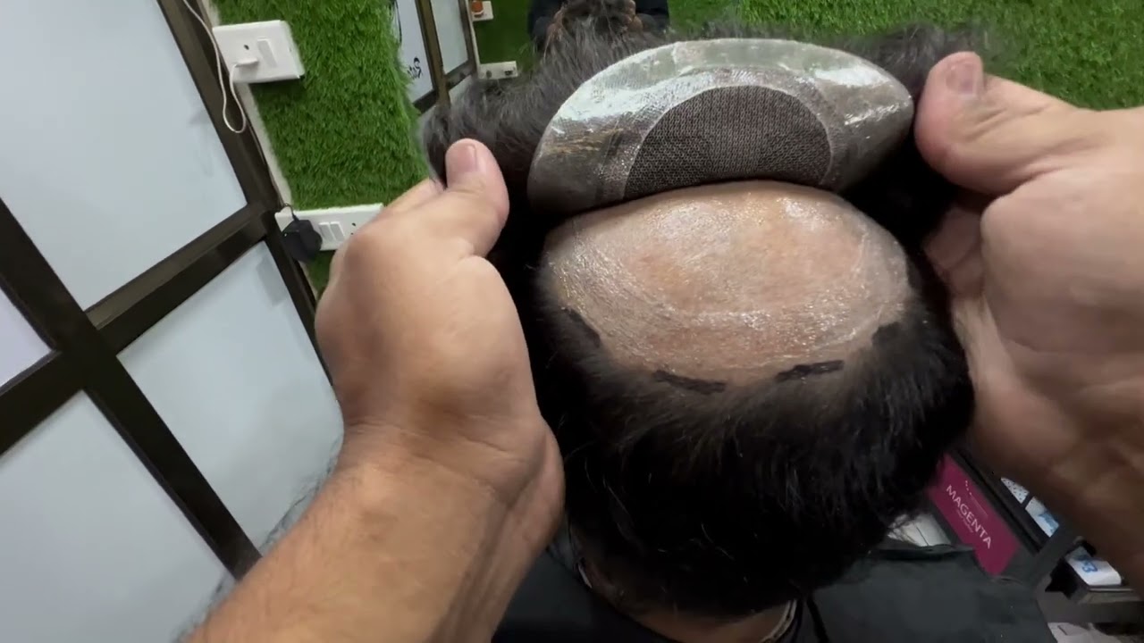 Australia hair patch in Mumbai / best hair patch in Mumbai Mulund /