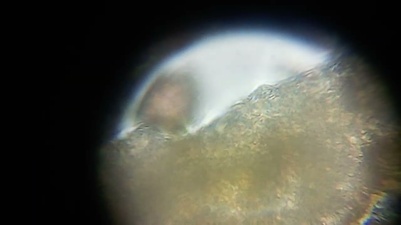 Tardigrade - found on foliose lichen on Rowan trunk (2)