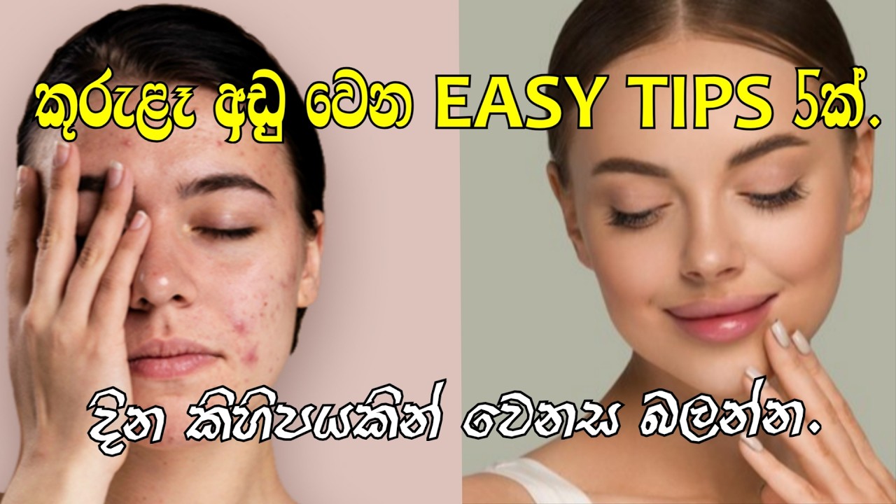 කුරුළෑවලට bye byee 👋 .මේ දේවල් කරලා බලන්න.#topten#fyp #viralvideo#2026#trending#pimples#how#srilanka