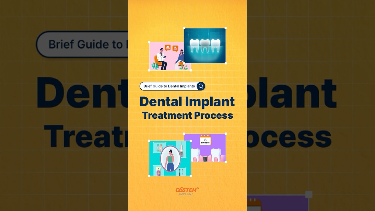 A Quick Look at the dental implant procedure in under 1 Minute #shorts