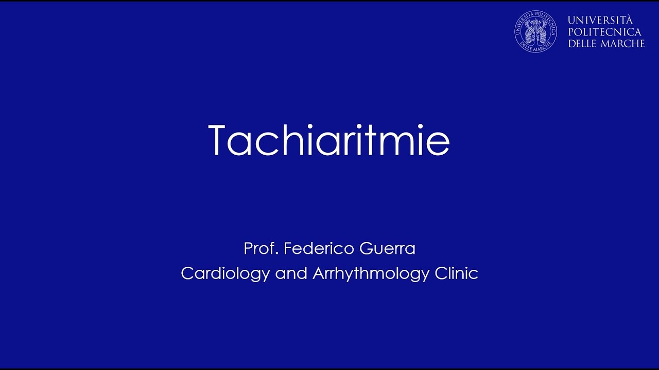 Tachiaritmie