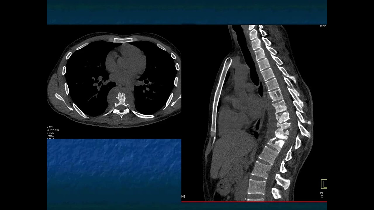 You Make the Call!  Freestyle Radiology Quiz #6