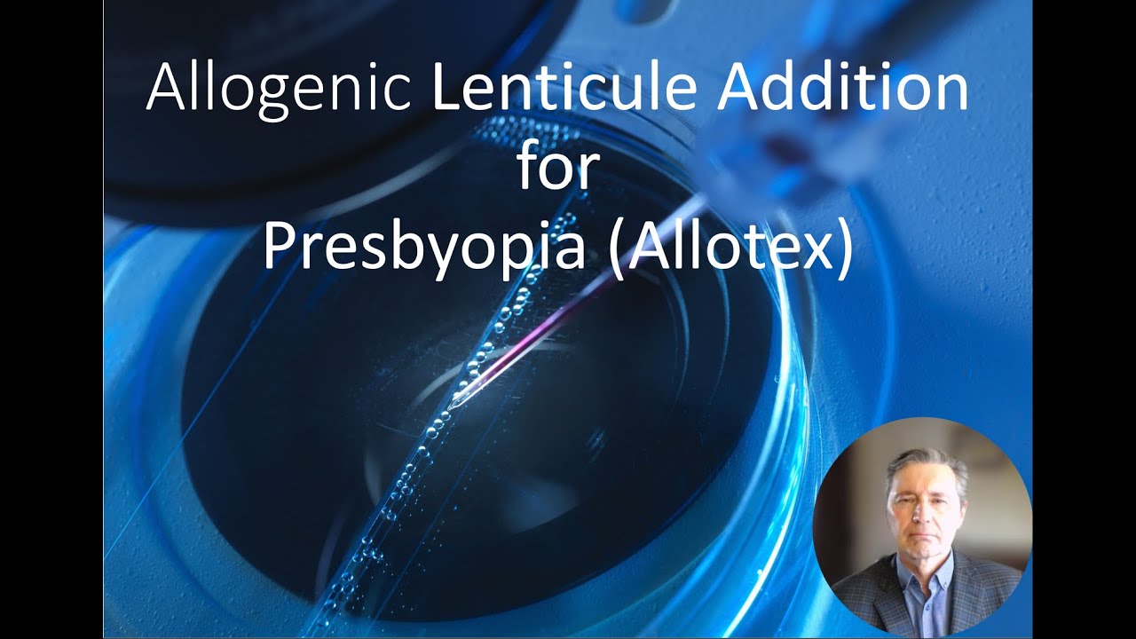 Allotex for Presbyopia World College of Refractive Surgery
