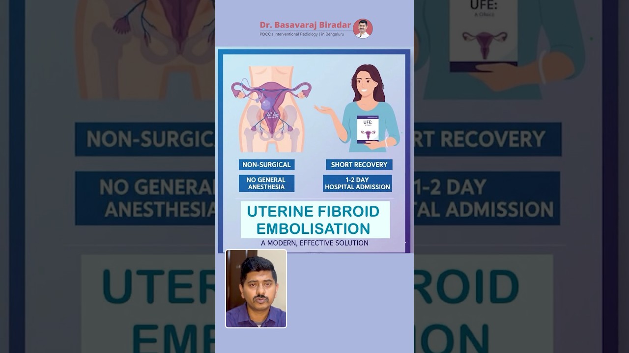 #fibroids ಫೈಬ್ರಾಯ್ಡ್ ಶಸ್ತ್ರಚಿಕಿತ್ಸೆ ಇಲ್ಲದೆ ಹೇಗೆ ಚಿಕಿತ್ಸೆ ಸಾಧ್ಯ?#bangalore #womenshealth #treatment