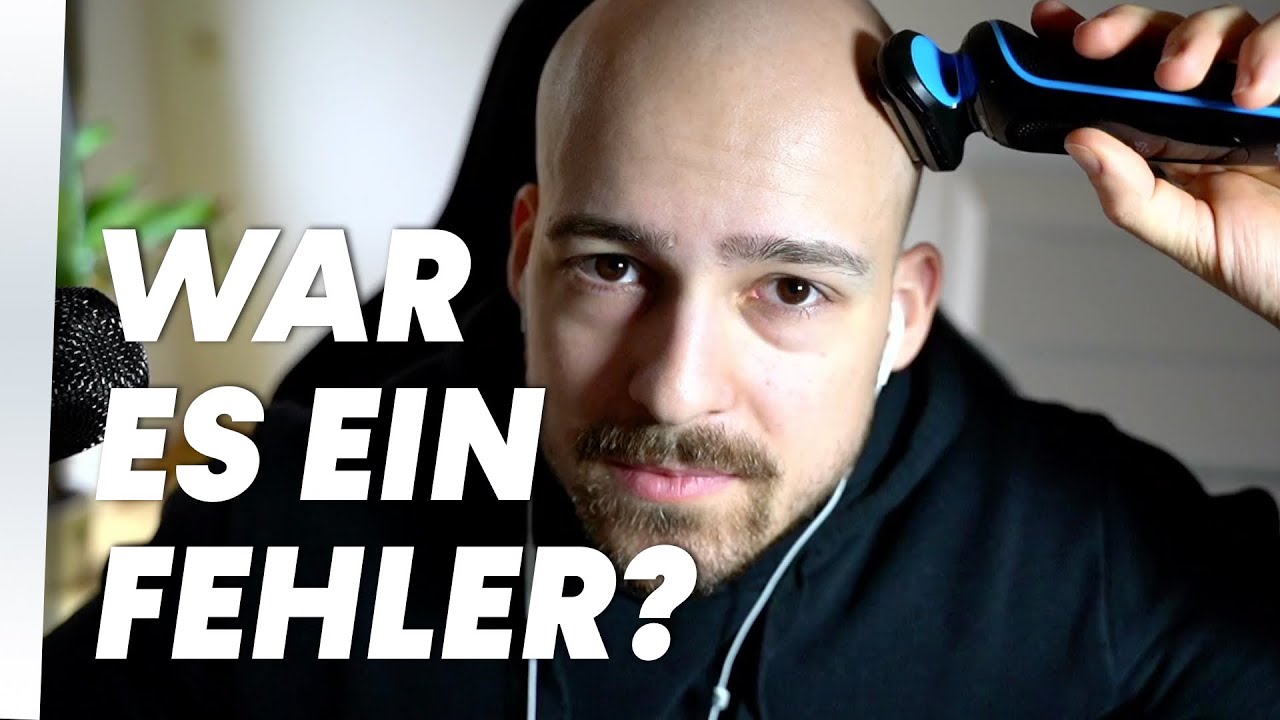 Glatze mit 24 - 3 1/2 Jahre Erfahrungsbericht