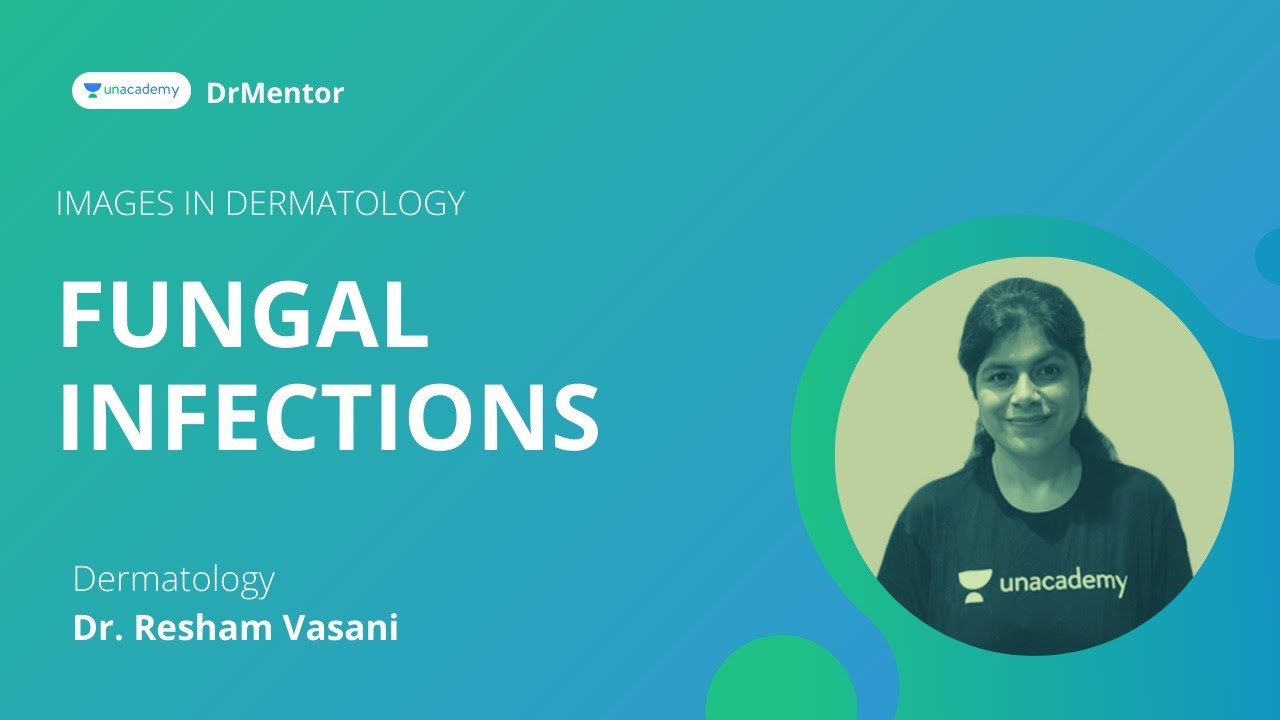 Must know images in Fungal infections | Dermatology | Dr. Resham