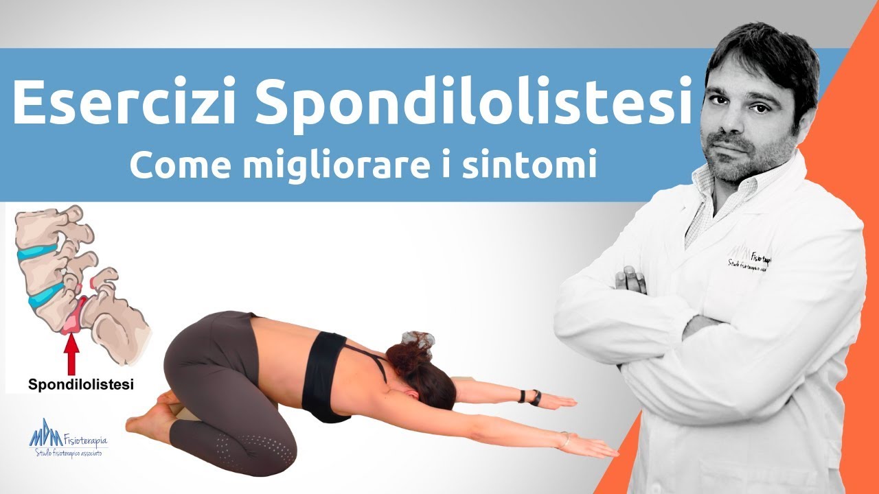 Esercizi Spondilolistesi | Come migliorare i sintomi