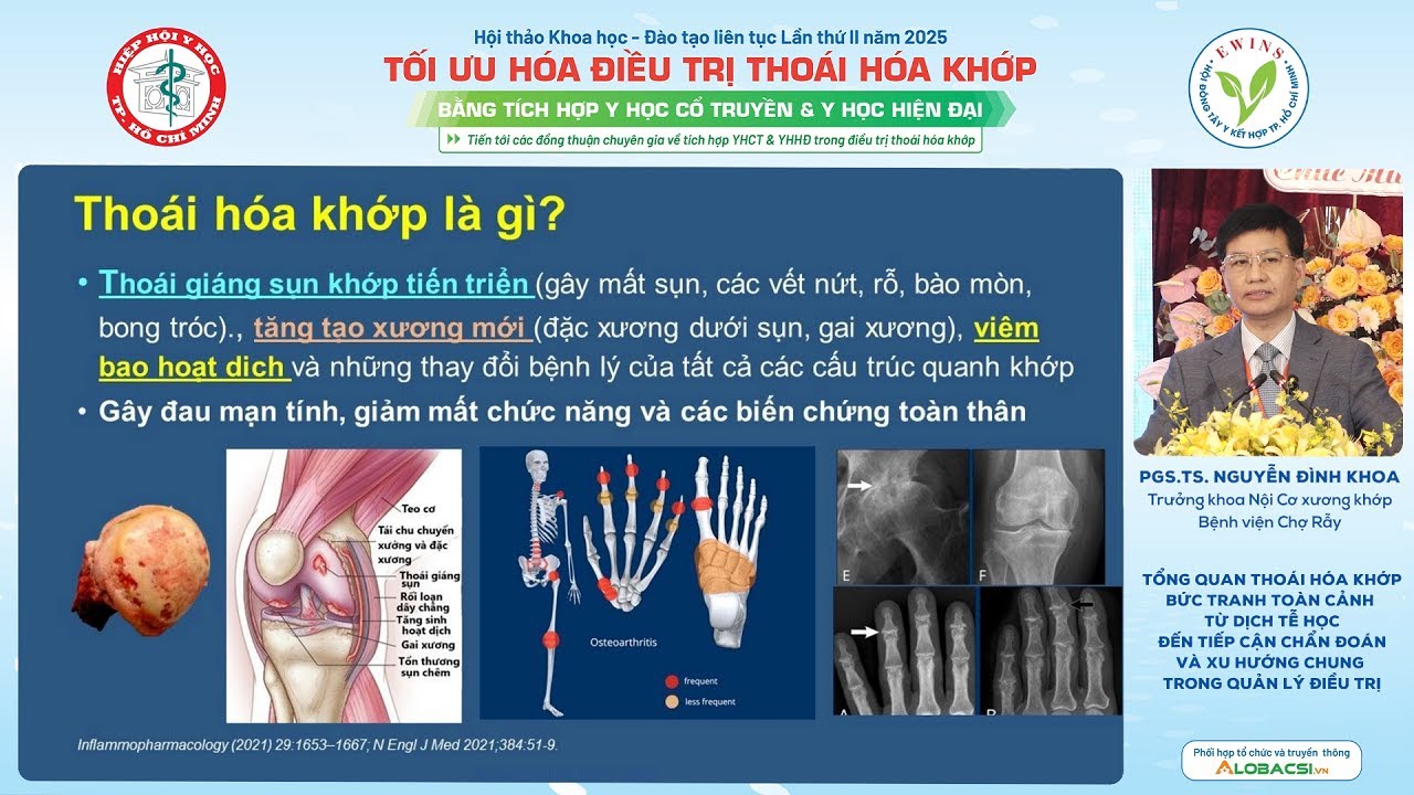 #1 Thoái hoá khớp: Chẩn đoán và điều trị