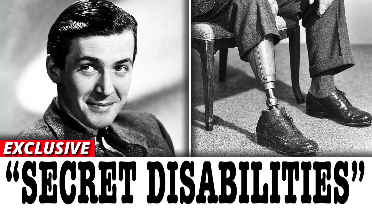 10 Old Hollywood Stars Who Hid SHOCKING Deformities and Disabilities