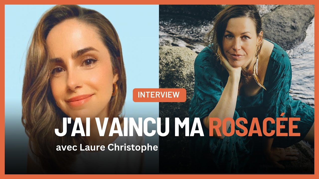 Comment je me suis débarrassée de ma rosacée : dysbiose, hypothyroïdie, stress - Live avec Laure