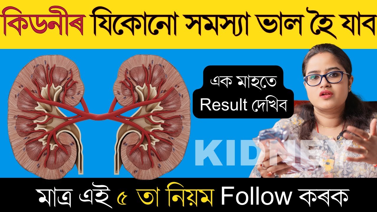 আপোনাৰ কিডনীক সকলো বেমাৰৰ পৰা বচাই ৰাখিবলৈ এই কেইটা কাম কৰক || Taking care of your Kidney Health