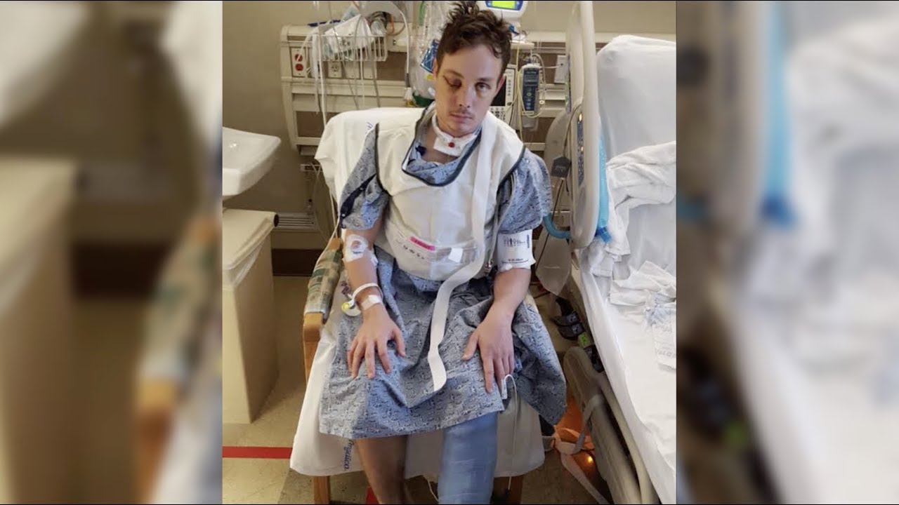 Fighting the battle: Creech Airman shares journey after almost deadly motorcycle accident
