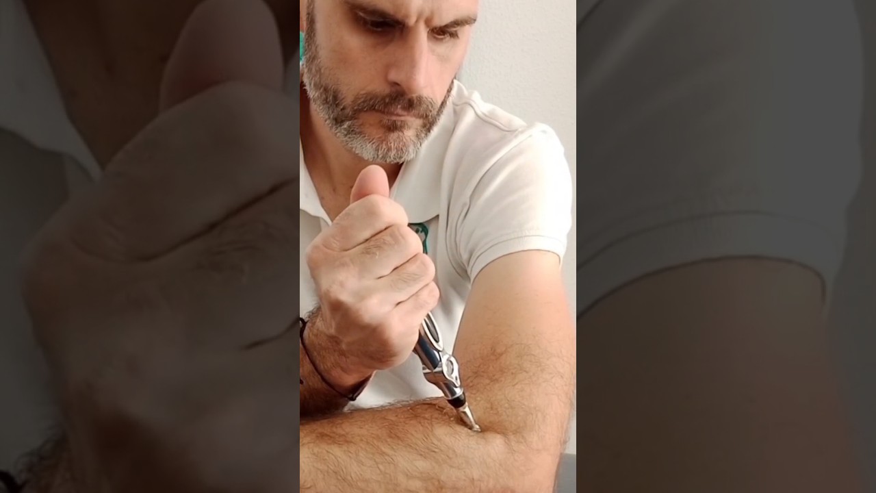 &iquest;C&oacute;mo se utiliza y para qu&eacute; sirve la pluma de acupuntura?